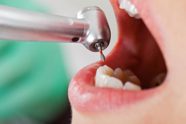 Best Emergency Dental Extractions in Poteau, OK